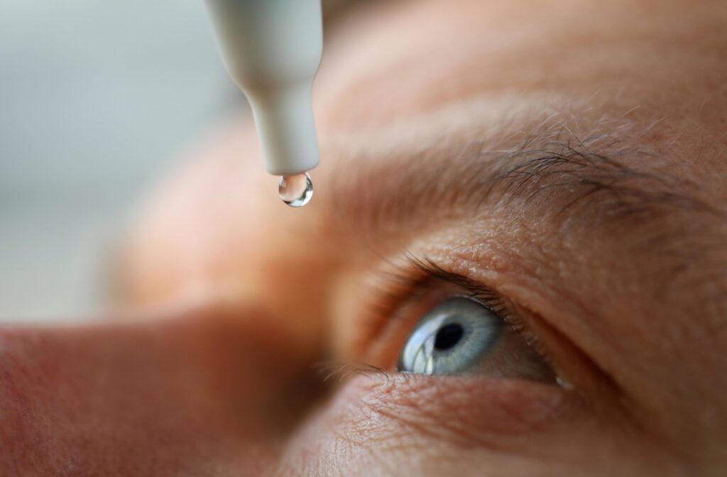 Closeup of someone using eyedrops.